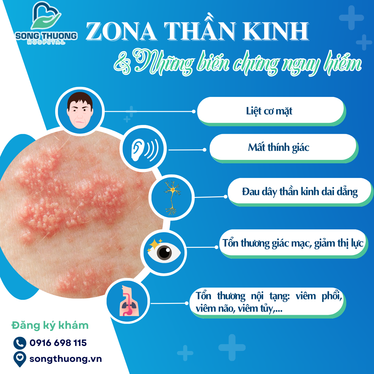 ZONA THẦN KINH VÀ NHỮNG BIẾN CHỨNG NGUY HIỂM